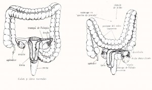 colon-utero